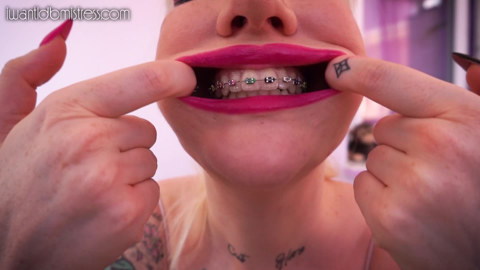 Braces Fetish Porn Tumblr - Braces Fetish - Porn Video Clips For Sale at iWantClips - Page 6